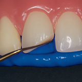 Matrix1™  Material 6 Mix Tips 50ml (2 Pack)